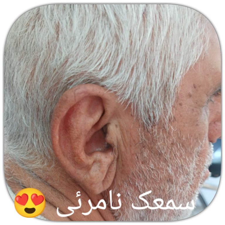 سمعک نامرئی اسلامشهر
