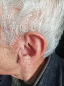 سمعک نامرئی در اسلامشهر