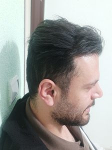 سمعک داخل گوشی در اسلامشهر 