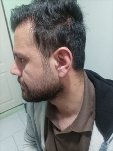 سمعک داخل گوشی اسلامشهر