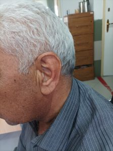سمعک اسلامشهر
